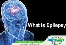 এপিলেপ্সি ,মৃগী,epilepsy