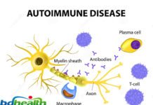 অটো ইমিউন ডিজিজ ,Auto Immune Disease
