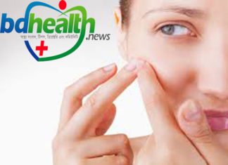 ব্রণ প্রতিরোধ,how to prevent acne