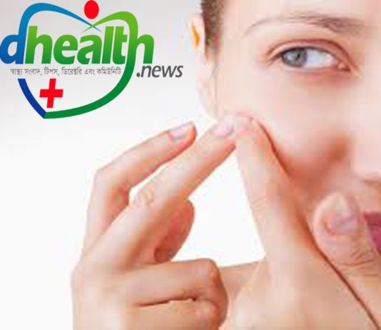 ব্রণ প্রতিরোধ,how to prevent acne